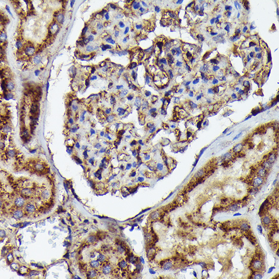 Human IgM Rabbit monoclonal antibody