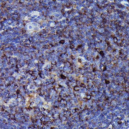 Human IgM Rabbit monoclonal antibody