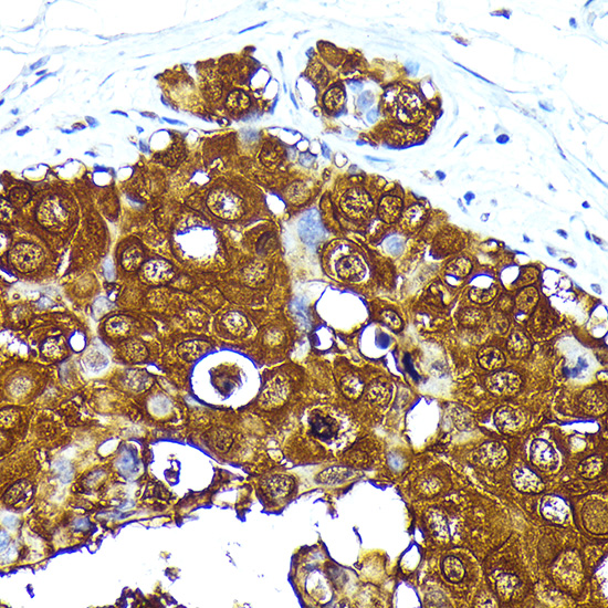Mammaglobin A Rabbit monoclonal antibody