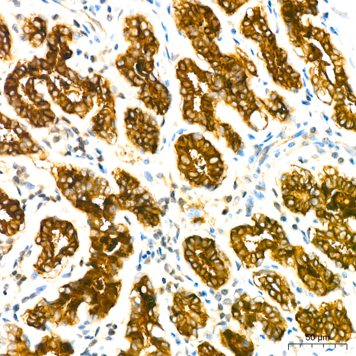 Mammaglobin A Rabbit monoclonal antibody