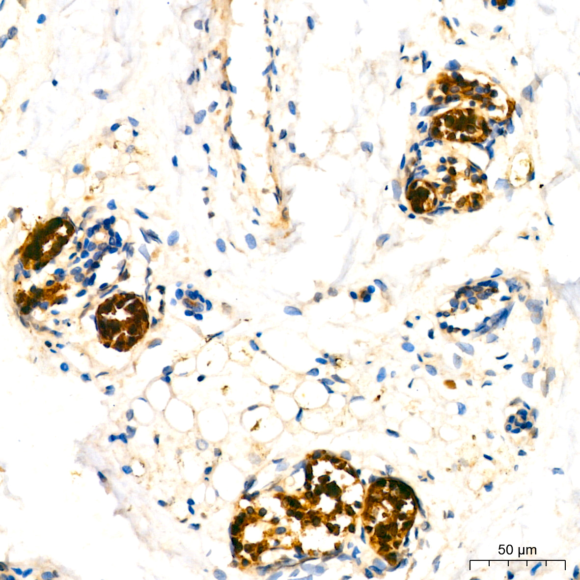 Mammaglobin A Rabbit monoclonal antibody