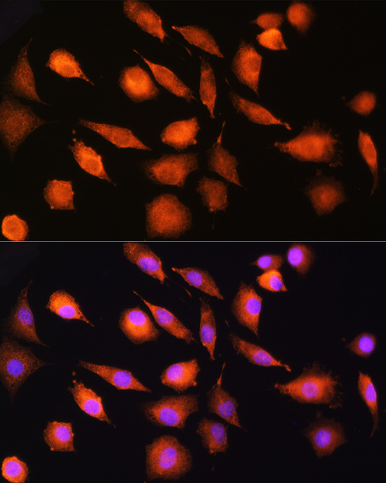 EXT2 Rabbit polyclonal antibody