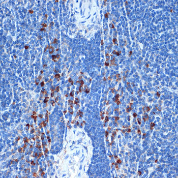 NAIP Rabbit monoclonal antibody
