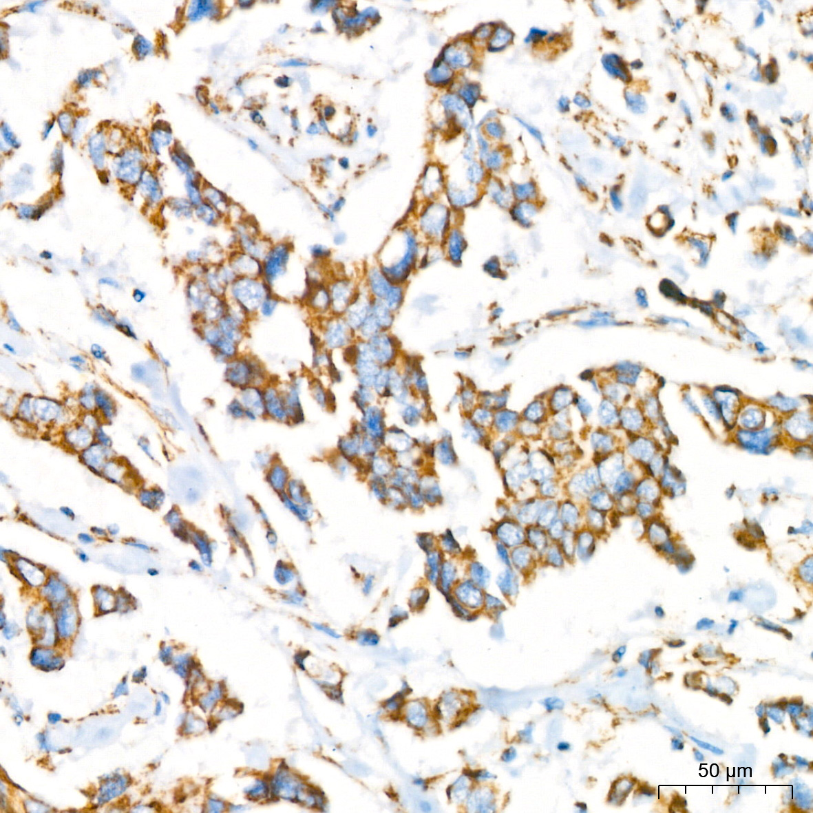 NDUFB8 Rabbit monoclonal antibody