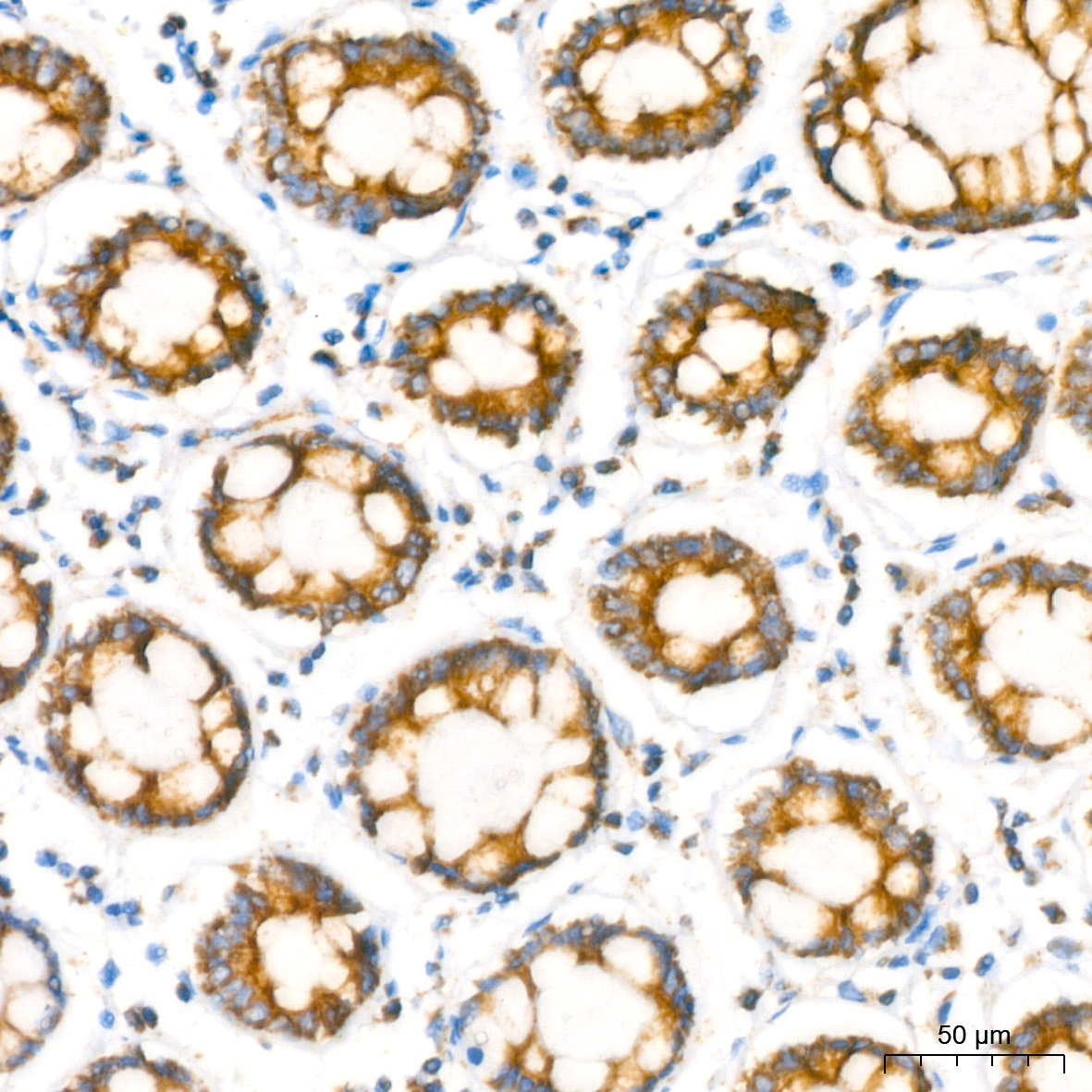 NDUFB8 Rabbit monoclonal antibody