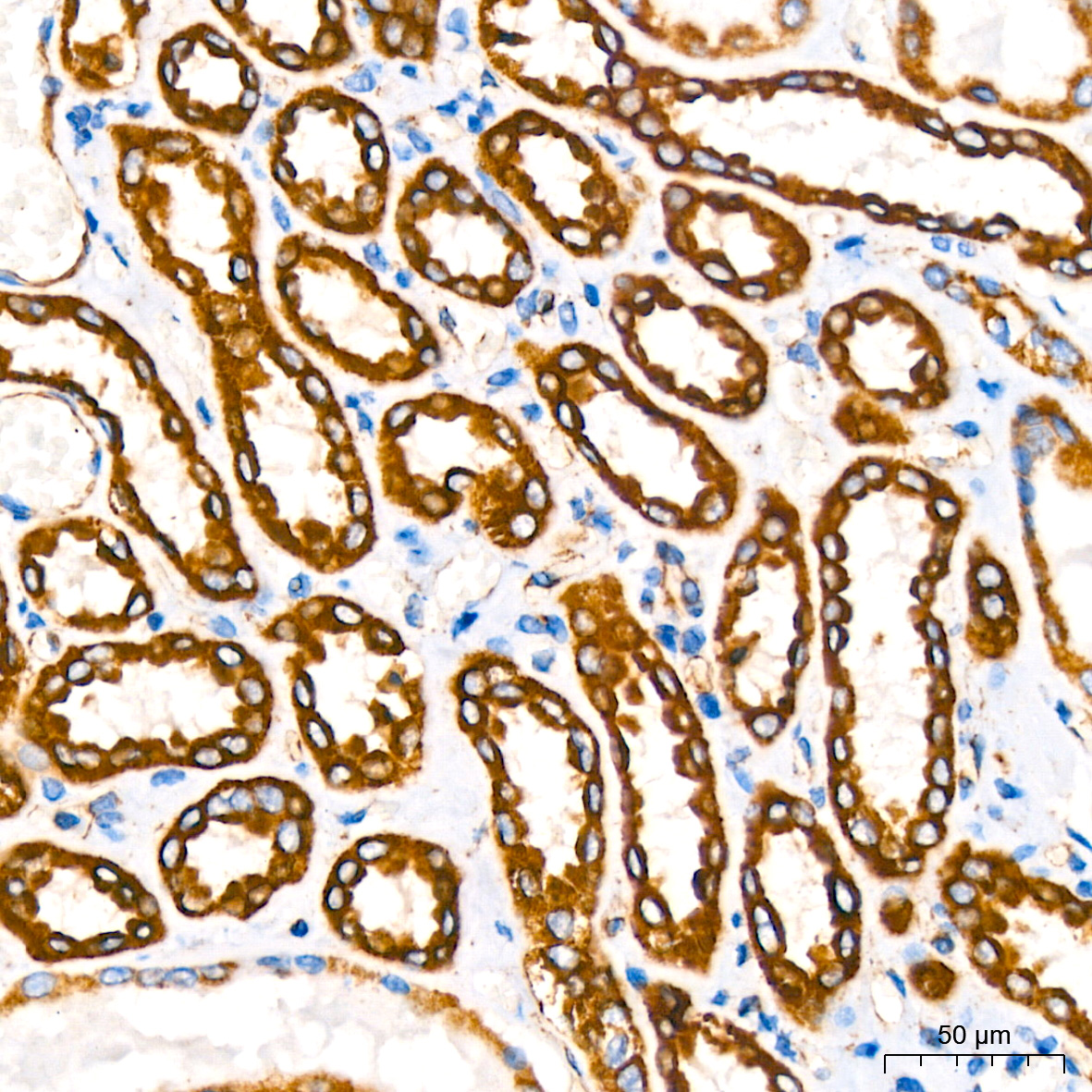 NDUFB8 Rabbit monoclonal antibody