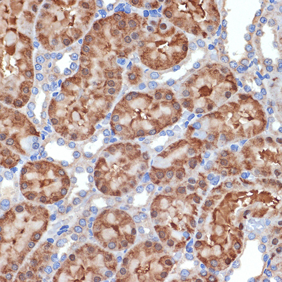 MEKK2 Rabbit monoclonal antibody