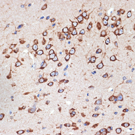 MEKK2 Rabbit monoclonal antibody