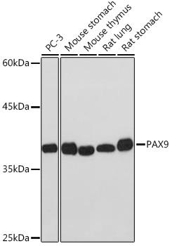 PAX9 Rabbit monoclonal antibody