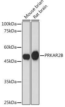 PRKAR2B Rabbit monoclonal antibody