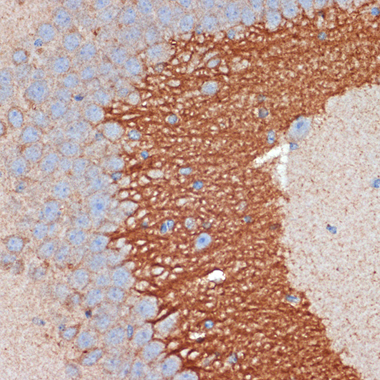 PRKAR2B Rabbit monoclonal antibody