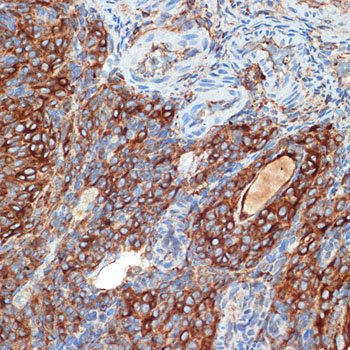PRKAR2B Rabbit monoclonal antibody
