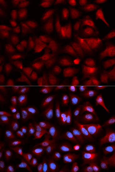 PSMB5 Rabbit polyclonal antibody