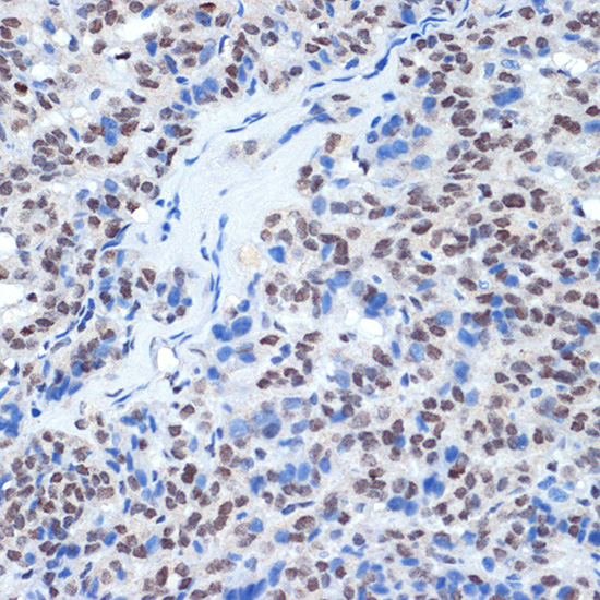 RING1A Rabbit monoclonal antibody