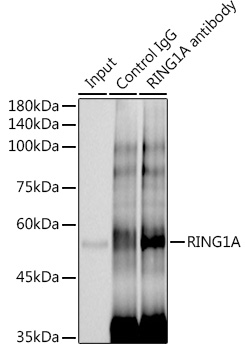 RING1A Rabbit monoclonal antibody