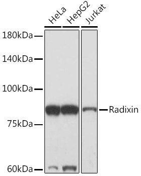 Radixin Rabbit monoclonal antibody