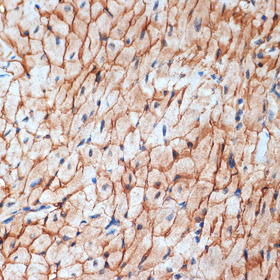 alpha Sarcoglycan (SGCA) Rabbit monoclonal antibody