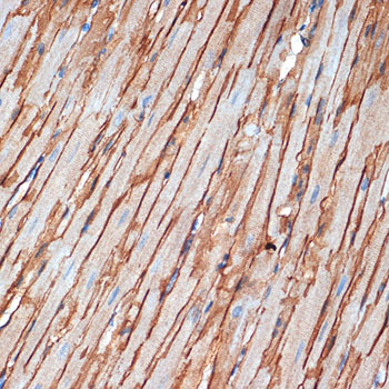 alpha Sarcoglycan (SGCA) Rabbit monoclonal antibody