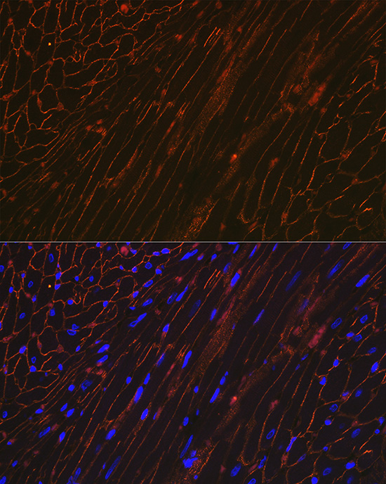 alpha Sarcoglycan (SGCA) Rabbit monoclonal antibody