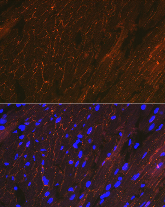 alpha Sarcoglycan (SGCA) Rabbit monoclonal antibody