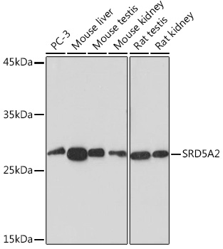 SRD5A2 Rabbit monoclonal antibody