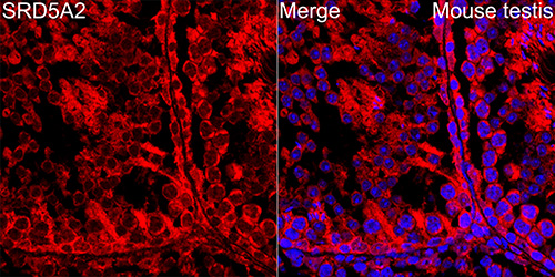 SRD5A2 Rabbit monoclonal antibody