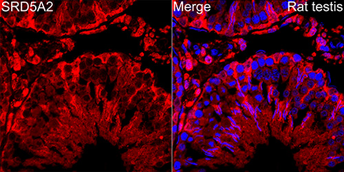 SRD5A2 Rabbit monoclonal antibody