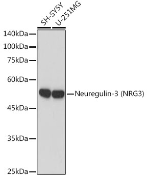 Neuregulin-3 (NRG3) Rabbit monoclonal antibody