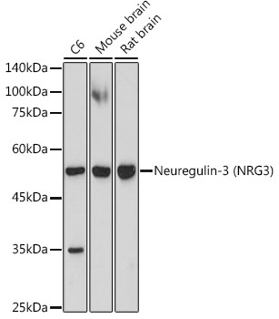Neuregulin-3 (NRG3) Rabbit monoclonal antibody