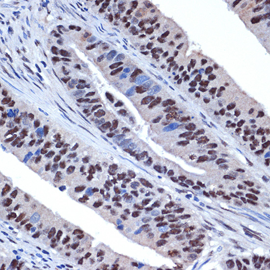 WDR4 Rabbit monoclonal antibody