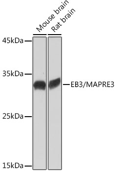 EB3/MAPRE3 Rabbit monoclonal antibody