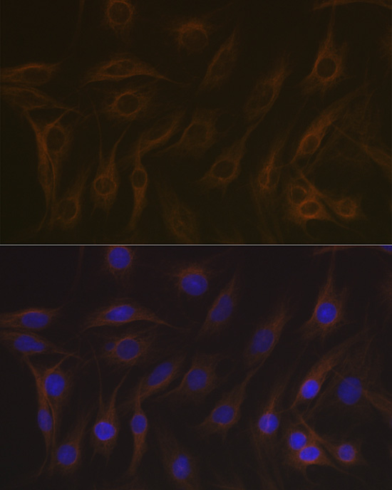 EB3/MAPRE3 Rabbit monoclonal antibody