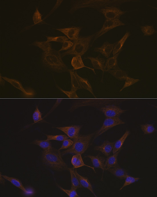 EB3/MAPRE3 Rabbit monoclonal antibody