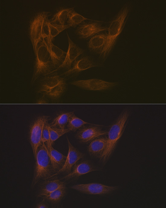 EB3/MAPRE3 Rabbit monoclonal antibody