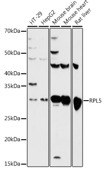 RPL5 Rabbit polyclonal antibody