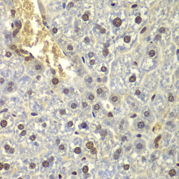 RPL5 Rabbit polyclonal antibody