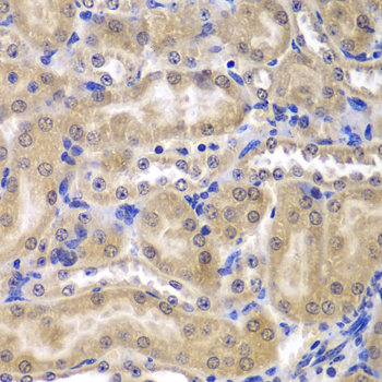 RPL5 Rabbit polyclonal antibody