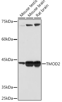 TMOD2 Rabbit monoclonal antibody