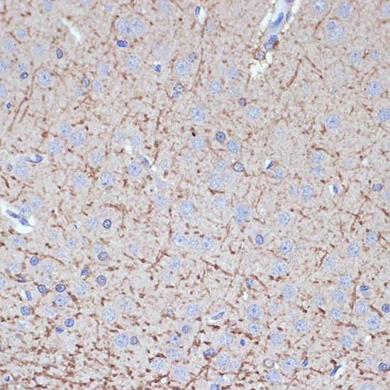 TMOD2 Rabbit monoclonal antibody