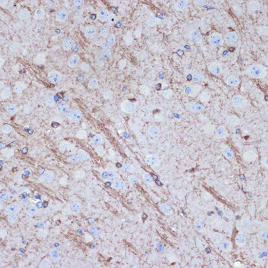 TMOD2 Rabbit monoclonal antibody