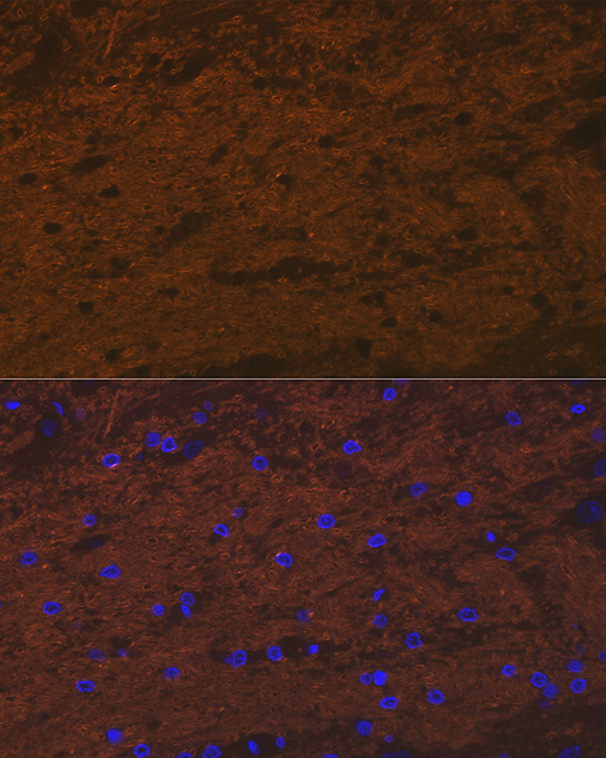 TMOD2 Rabbit monoclonal antibody