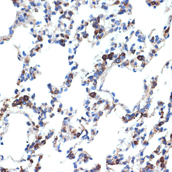 ERp29 Rabbit monoclonal antibody