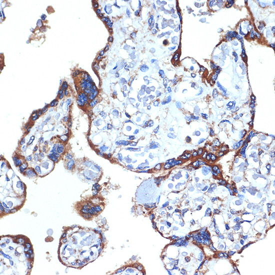 ERp29 Rabbit monoclonal antibody
