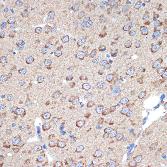 ERp29 Rabbit monoclonal antibody
