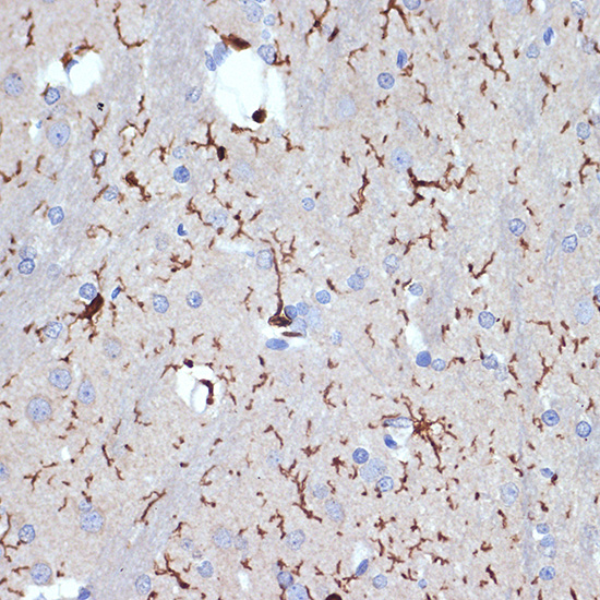 AIF1/IBA1 Rabbit monoclonal antibody
