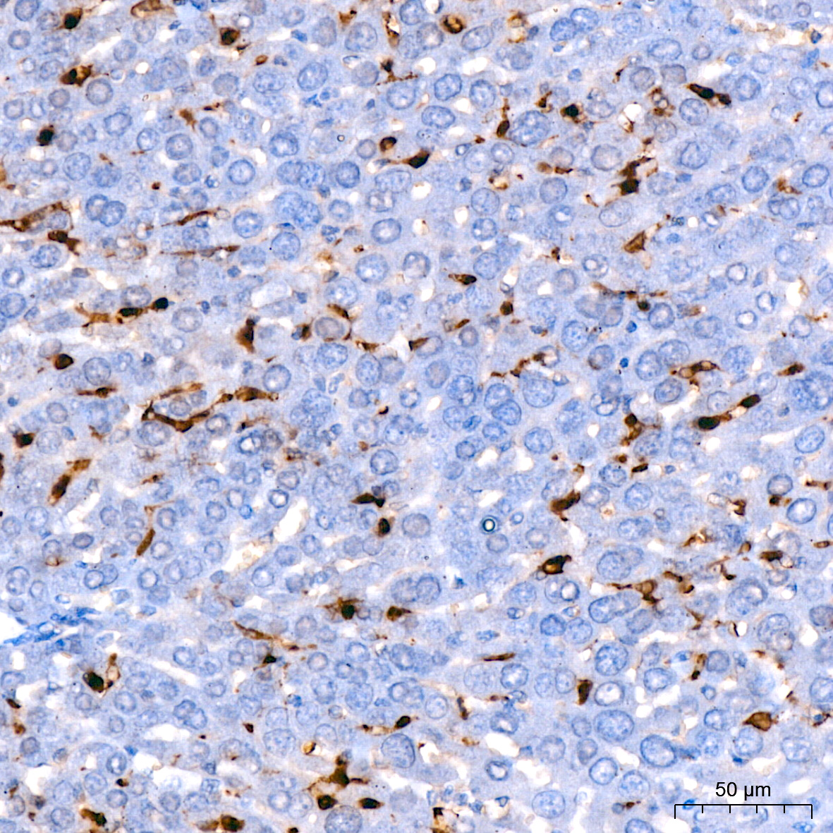 AIF1/IBA1 Rabbit monoclonal antibody