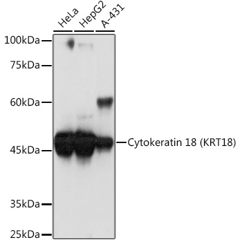 Cytokeratin 18 (KRT18) Rabbit mAb