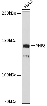 PHF8 Rabbit monoclonal antibody