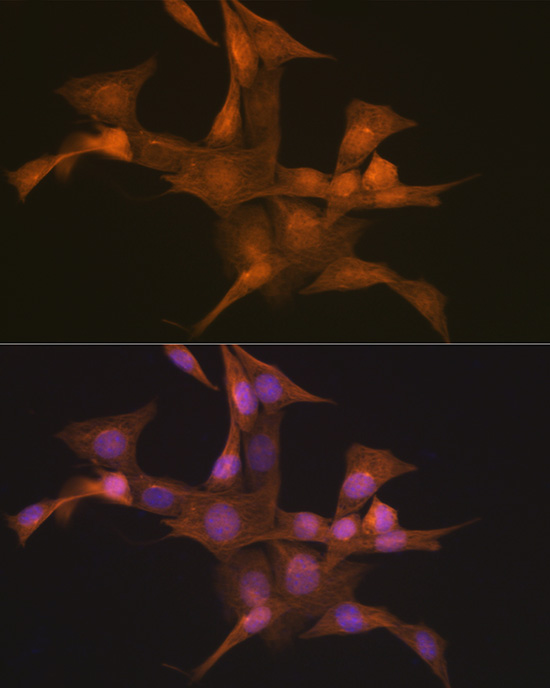 Nesprin 1 Rabbit monoclonal antibody