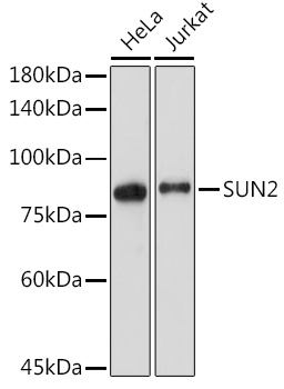 SUN2 Rabbit monoclonal antibody